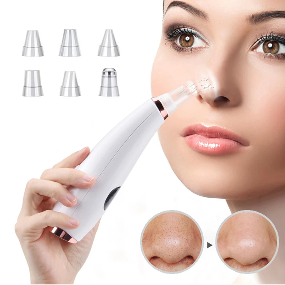 Revolutionary Electric Blackhead Remover – Deep Cleansing for Flawless Skin!"