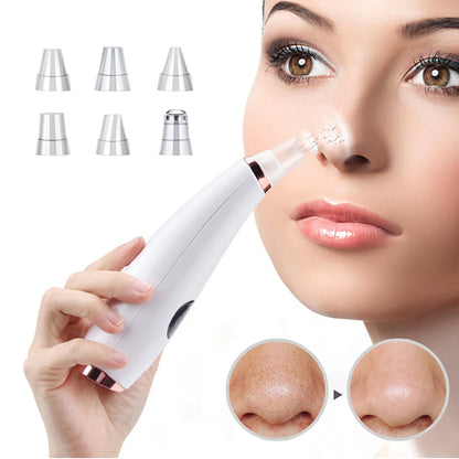 Revolutionary Electric Blackhead Remover – Deep Cleansing for Flawless Skin!"