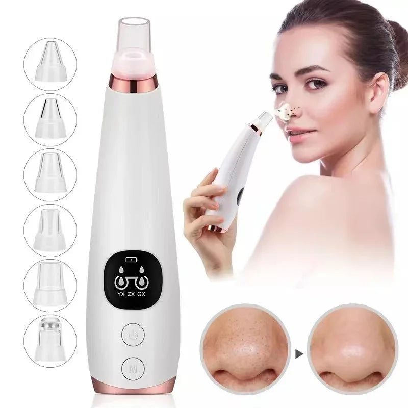 Revolutionary Electric Blackhead Remover – Deep Cleansing for Flawless Skin!"