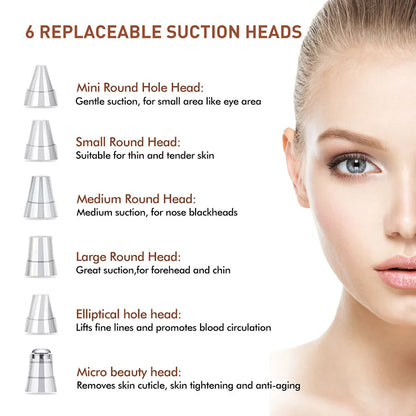 Revolutionary Electric Blackhead Remover – Deep Cleansing for Flawless Skin!"